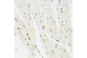 Immunohistochemistry of paraffin-embedded mouse heart using THAP1 antibody. (THAP1 anticorps)