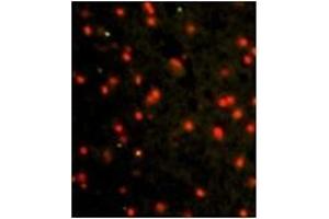 Image no. 1 for anti-Cadherin 4 (CDH4) (AA 182-211), (N-Term) antibody (ABIN356865)