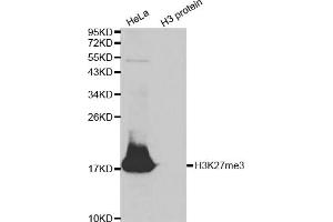 Western blot analysis of extracts of various cell lines, using Trimethyl-Histone H3-K27 antibody (ABIN5969810) at 1/500 dilution. (Histone 3 anticorps  (H3K27me3))