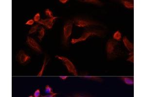 Immunofluorescence analysis of U2OS cells using TYMS Polyclonal Antibody at dilution of 1:100. (TYMS anticorps)