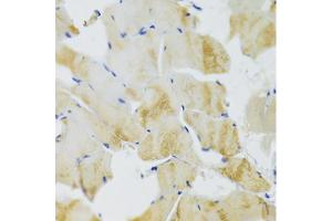 Immunohistochemistry of paraffin-embedded rat skeletal muscle using TRAP1 Antibody (ABIN1875197) at dilution of 1:100 (40x lens). (TRAP1 anticorps)