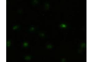 Immunofluorescent staining of HeLa cells using anti-MAPK8 mouse monoclonal antibody (ABIN2452378). (JNK anticorps  (AA 1-384))
