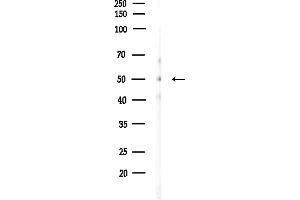 anti-Pyruvate Dehydrogenase Kinase, Isozyme 4 (PDK4) (C-Term) antibody