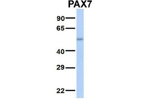 Host:  Rabbit  Target Name:  SERPINA3  Sample Type:  Human Adult Placenta  Antibody Dilution:  1. (PAX7 anticorps  (Middle Region))