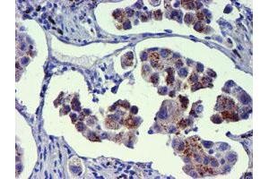 Image no. 5 for anti-Golgi Membrane Protein 1 (GOLM1) antibody (ABIN1498494) (GOLM1 anticorps)