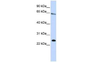 ZNF326 antibody used at 0. (ZNF326 anticorps  (N-Term))