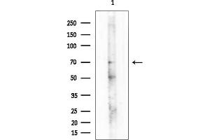 Western blot analysis of lysates from Mouse testis, using Phospho-NF-kB p65 (Ser468) Antibody at 1/1000 dilution.