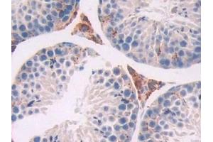 Detection of TPP1 in Mouse Testis Tissue using Polyclonal Antibody to Tripeptidyl Peptidase I (TPP1)