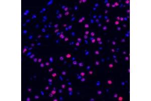 Immunofluorescent analysis of paraformaldehyde-fixed mouse brain using ADRA1B (ABIN7072974) at dilution of 1: 1200 (ADRA1B anticorps)