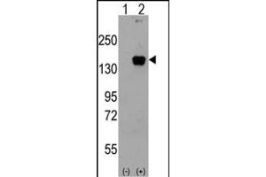 Western blot analysis of P3K5 (arrow) using rabbit polyclonal P3K5 Antibody g. (ASK1 anticorps  (AA 821-849))
