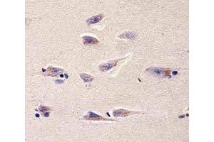 Immunohistochemical analysis of paraffin-embedded human brain section using DHFR antibody; Ab was diluted at 1:25 dilution.