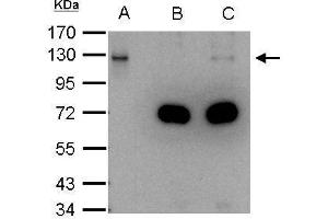 IP Image DDB1 antibody immunoprecipitates DDB1 protein in IP experiments. (DDB1 anticorps  (C-Term))