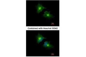 ICC/IF Image Immunofluorescence analysis of methanol-fixed HeLa, using SCAMP3, antibody at 1:1000 dilution. (SCAMP3 anticorps)