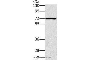 Western blot analysis of Raji cell, using PLS3 Polyclonal Antibody at dilution of 1:400 (Plastin 3 anticorps)