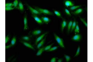 Immunofluorescence staining of Hela cells with ABIN7175108 at 1:33, counter-stained with DAPI. (UMPS anticorps  (AA 314-444))