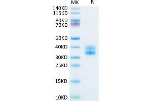 Biotinylated Human 4-1BB on Tris-Bis PAGE under reduced condition.