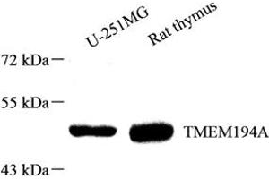Western blot analysis of TMEM194A (ABIN7075997) at dilution of 1: 1000 (TMEM194A anticorps)