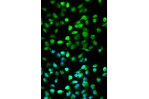 Immunofluorescence analysis of HeLa cell using TCF4 antibody. (TCF4 anticorps)