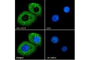 (ABIN185715) Immunofluorescence analysis of paraformaldehyde fixed KNRK cells, permeabilized with 0.