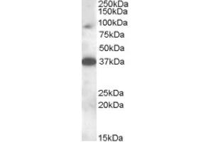 Image no. 1 for anti-Membrane-Associated Ring Finger (C3HC4) 10, E3 Ubiquitin Protein Ligase (MARCH10) (Internal Region) antibody (ABIN375020) (MARCH10 anticorps  (Internal Region))