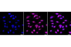 Immunocytochemical staining of HepG2 cells with JunD antibody (ABIN7799143), 1:1,000). (Recombinant JunD anticorps)