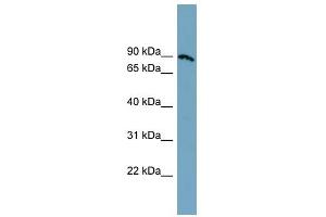 SLC6A14 antibody used at 1 ug/ml to detect target protein.