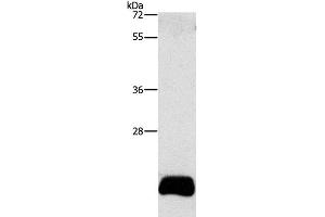 Western Blot analysis of PC3 cell using APOBEC3C Polyclonal Antibody at dilution of 1:420 (APOBEC3C anticorps)
