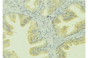 ABIN6273028 at 1/100 staining Mouse colon tissue by IHC-P. (SLC30A6 anticorps  (Internal Region))
