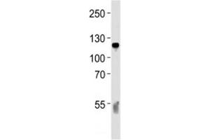 Western blot analysis of lysate from human blood plasma tissue lysate using C6 antibody diluted at 1:1000 for each lane.
