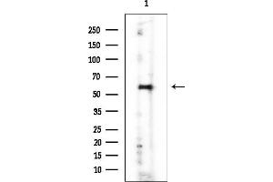 anti-Aldehyde Dehydrogenase 3 Family, Member A2 (ALDH3A2) antibody