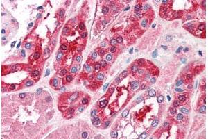 Human Kidney (formalin-fixed, paraffin-embedded) stained with MID2 antibody ABIN337007 at 5 ug/ml followed by biotinylated anti-goat IgG secondary antibody ABIN481715, alkaline phosphatase-streptavidin and chromogen. (Midline 2 anticorps  (AA 723-735))