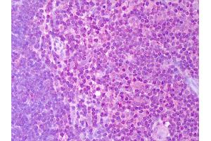 Anti-IL-2 antibody IHC of human thymus. (IL-2 anticorps)