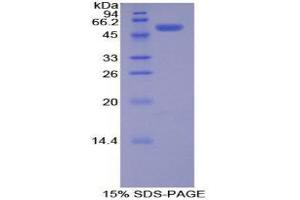 SDS-PAGE (SDS) image for PDGF-BB Homodimer (AA 13-241) protein (His tag,GST tag) (ABIN1877556) (PDGF-BB Homodimer (AA 13-241) protein (His tag,GST tag))