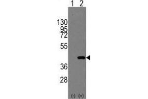 Western blot analysis of MAPK14(arrow) using rabbit polyclonal MAPK14 Antibody (Y322) . (MAPK14 anticorps  (Tyr322))