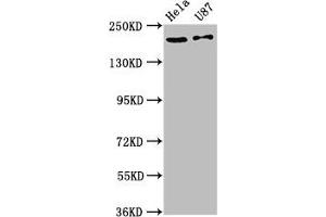 Western Blot Positive WB detected in: Hela whole cell lysate, U87 whole cell lysate All lanes: SCN10A antibody at 12 μg/mL Secondary Goat polyclonal to rabbit IgG at 1/50000 dilution Predicted band size: 221 kDa Observed band size: 221 kDa