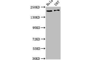 Western Blot Positive WB detected in: Hela whole cell lysate, U87 whole cell lysate All lanes: SCN10A antibody at 12 μg/mL Secondary Goat polyclonal to rabbit IgG at 1/50000 dilution Predicted band size: 221 kDa Observed band size: 221 kDa (SCN1A anticorps  (AA 992-1099))
