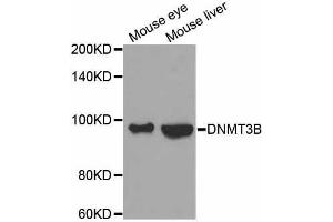 Western blot analysis of extracts of various cell lines, using DNMT3B antibody. (DNMT3B anticorps)