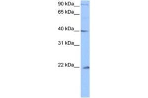 Western Blotting (WB) image for anti-Chromosome 4 Open Reading Frame 33 (C4orf33) antibody (ABIN2463479) (C4orf33 anticorps)