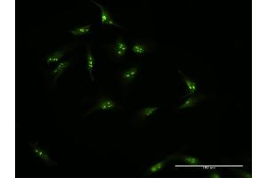 Immunofluorescence of purified MaxPab antibody to NOP16 on HeLa cell.