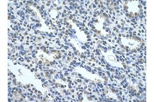 Rabbit Anti-NR2F2 Antibody ,Paraffin Embedded Tissue: Human alveolar cell  Cellular Data: Epithelial cells of renal tubule  Antibody Concentration: 4.