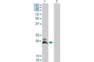 Western Blot analysis of HAND2 expression in transfected 293T cell line by HAND2 monoclonal antibody (M01), clone 4H8. (HAND2 anticorps  (AA 135-216))