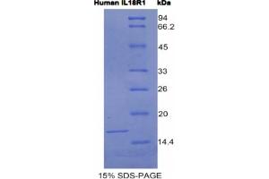 SDS-PAGE analysis of Human IL18R1 Protein. (IL18R1 Protéine)