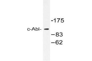 Western blot analysis of c-Abl Antibody in extracts from 293 cells. (ABL1 anticorps)