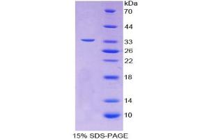 Image no. 1 for Glycoprotein Ib (Platelet), alpha Polypeptide (GP1BA) (AA 19-291) protein (T7 tag,His tag) (ABIN6240034)