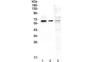 Western blot testing of 1) rat kidney, 2) mouse kidney and 3) human MDA-MB-231 lysate with COBRA1 antibody at 0.