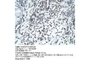 Human kidney (SIRT5 anticorps  (Middle Region))