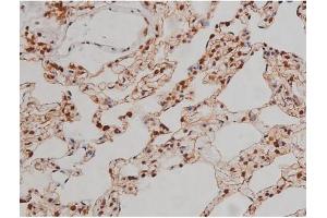 ABIN6267336 at 1/200 staining Rat lung tissue sections by IHC-P. (IGF1R anticorps  (pTyr1346))