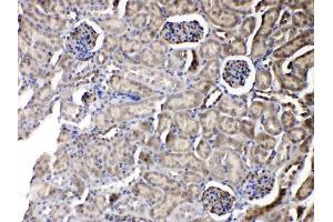 IHC analysis of PNP using anti-PNP antibody .