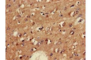 Immunohistochemistry of paraffin-embedded human brain tissue using ABIN7153954 at dilution of 1:100
