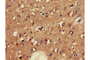 Immunohistochemistry of paraffin-embedded human brain tissue using ABIN7153954 at dilution of 1:100 (GAD65 anticorps  (AA 1-82))